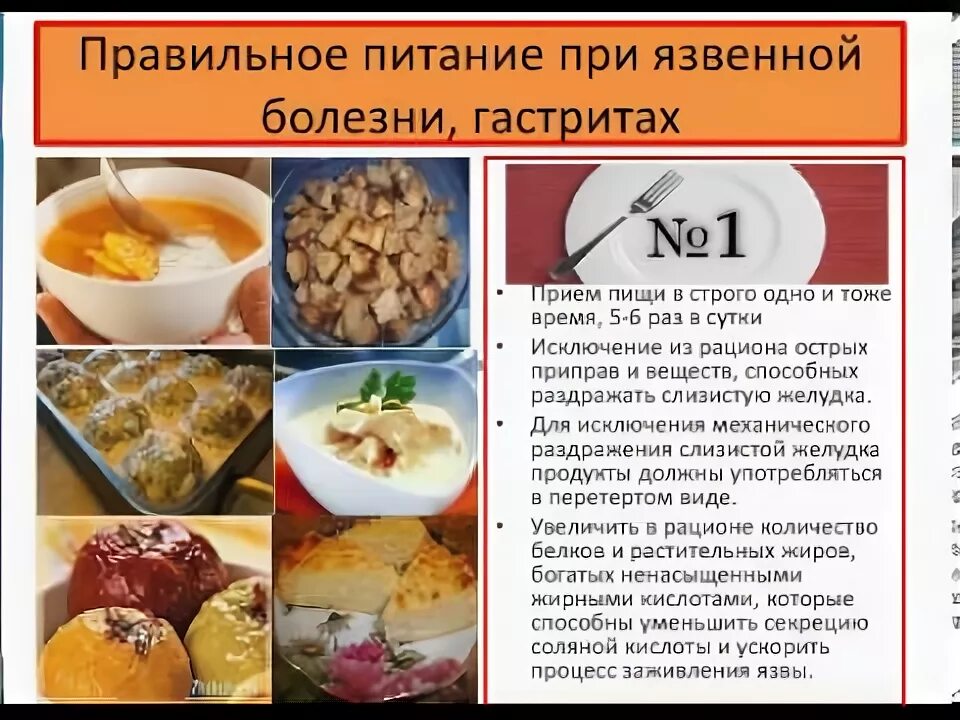 Какие продукты можно при язве желудка. Памятка по питанию с язвенной болезнью желудка. Питание при язве. Диета при гастрите язвенной болезни. Диета при язвенном заболевании желудка.