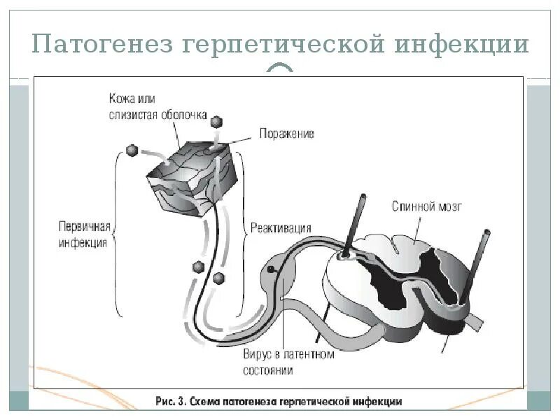 Вирус простого вируса 1 2. Вирус простого герпеса патогенез схема. патогенез вируса герпеса 1 и 2 типа. патогенез герпетической инфекции схема.