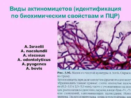 Таксономия актиномицетов