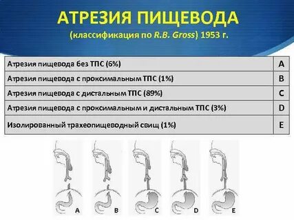 Атрезия пищевода мкб