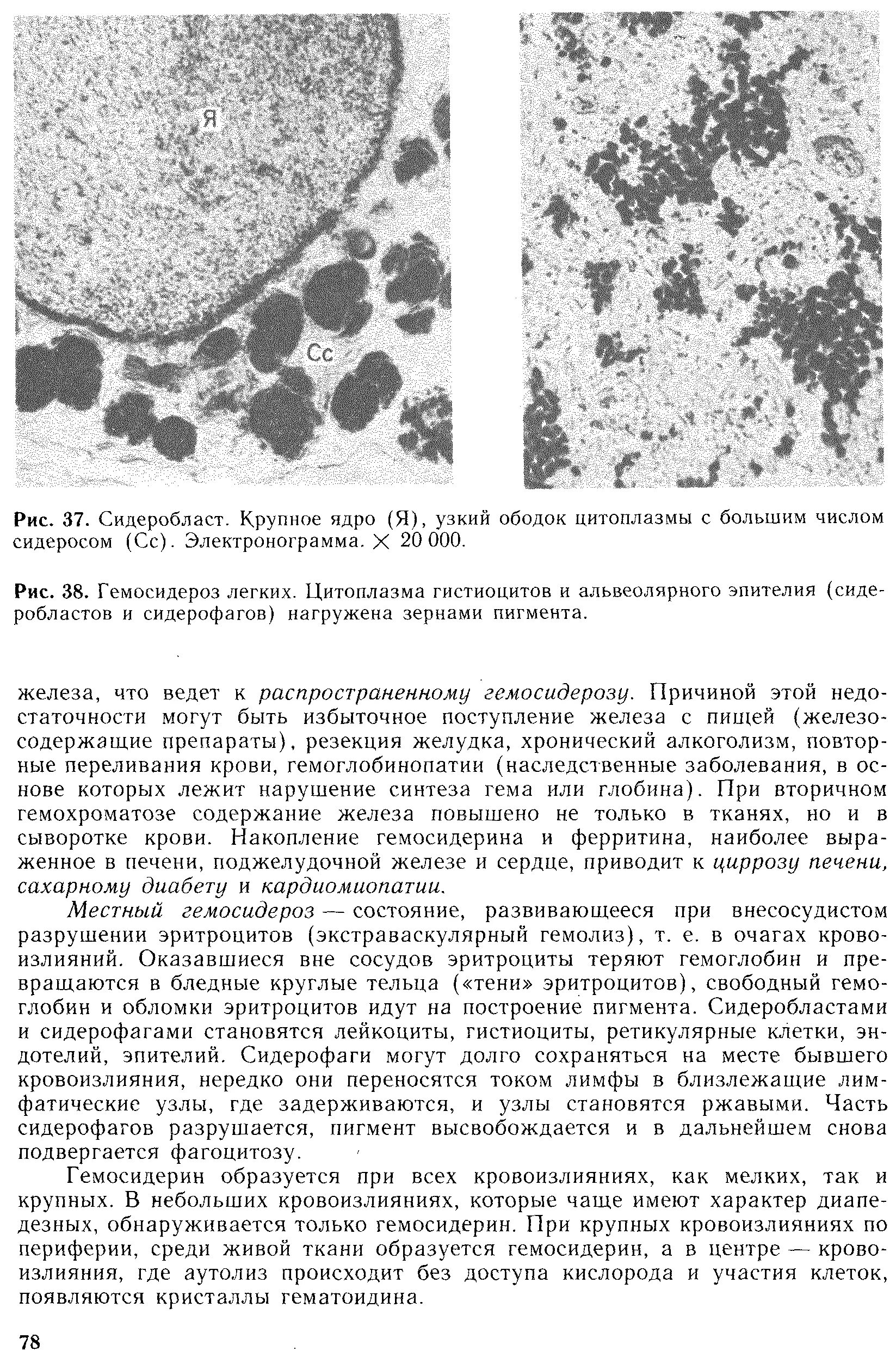 Гистиоциты функции. Гистиоциты это. Гистиоциты функции. Макрофаги гистиоциты. Гистиоциты соединительной ткани.