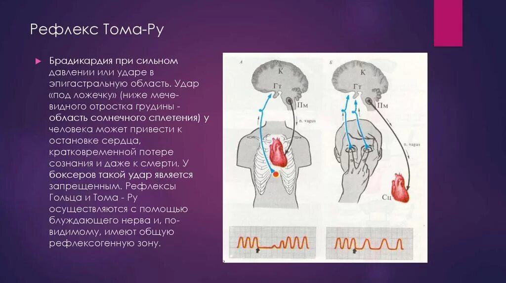 Данини Ашнера рефлекс механизм. Эпигастральный рефлекс Тома ру. Рефлекс гольца и Данини-Ашнера. Рефлекс Данини Ашнера физиология.