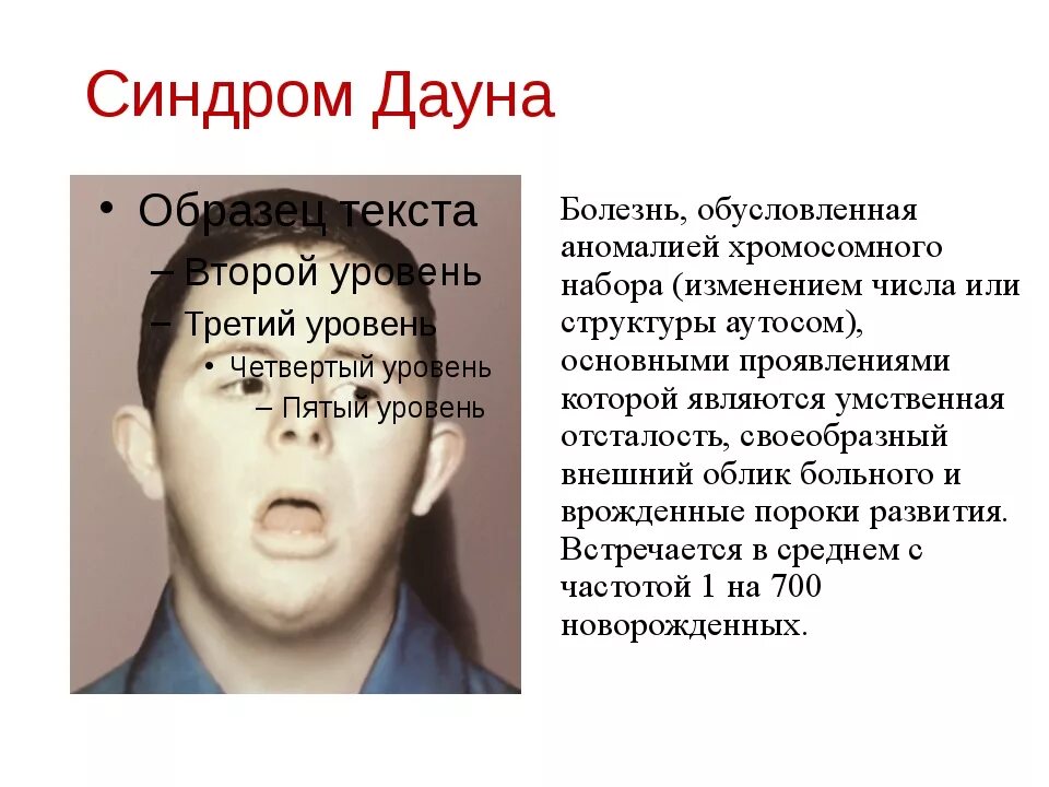 Болезнь дауна причины. Проявления болезни Дауна. Основная причина болезни Дауна.