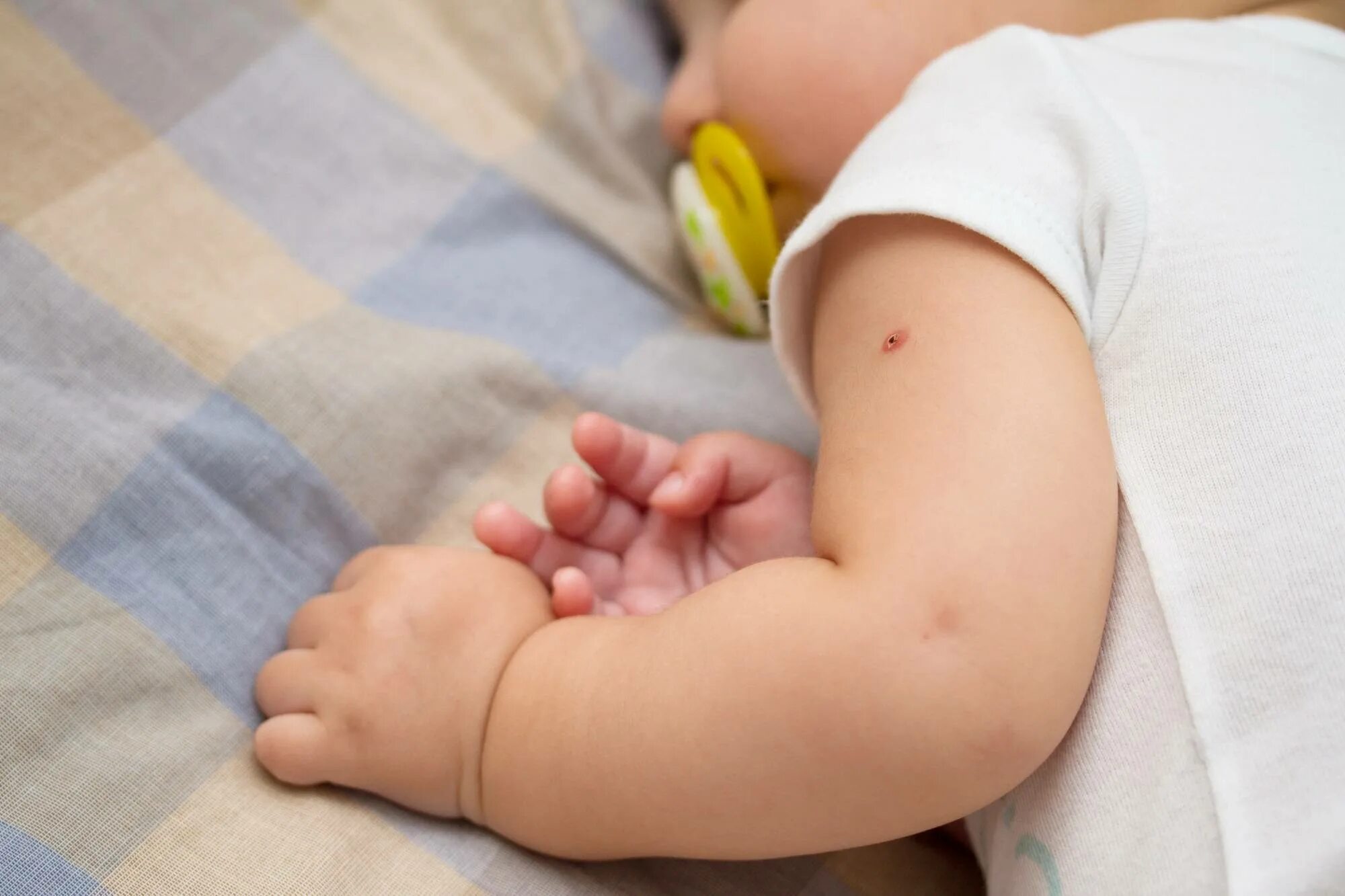 Местная реакция после. БЦЖ вакцина для новорожденных. БЦЖ прививка новорожденным.