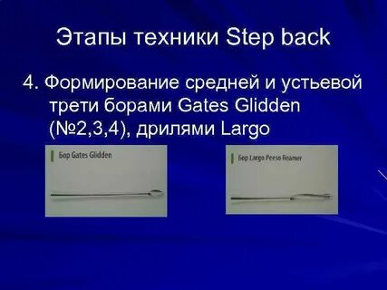 No step back