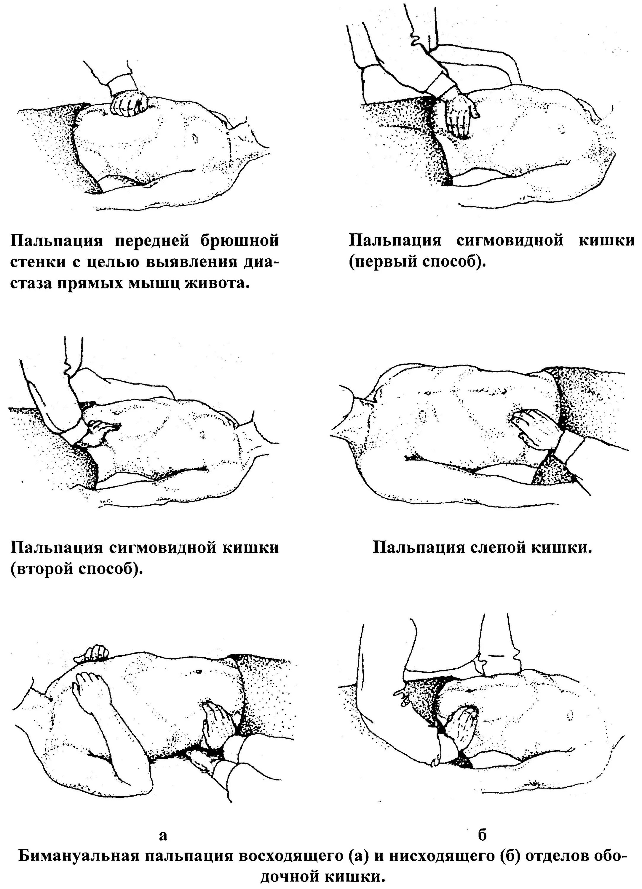 Пальпация живота. Схема поверхностной пальпации живота. Пальпация ЖКТ пропедевтика схема. Пальпация органов брюшной полости алгоритм. Схема пальпации брюшной полости.