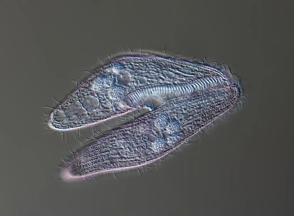 Инфузория Vorticella. Кархезиум инфузория. Инфузория туфелька конъюгация. Инфузория туфелька под микроскопом. Передвижение инфузории