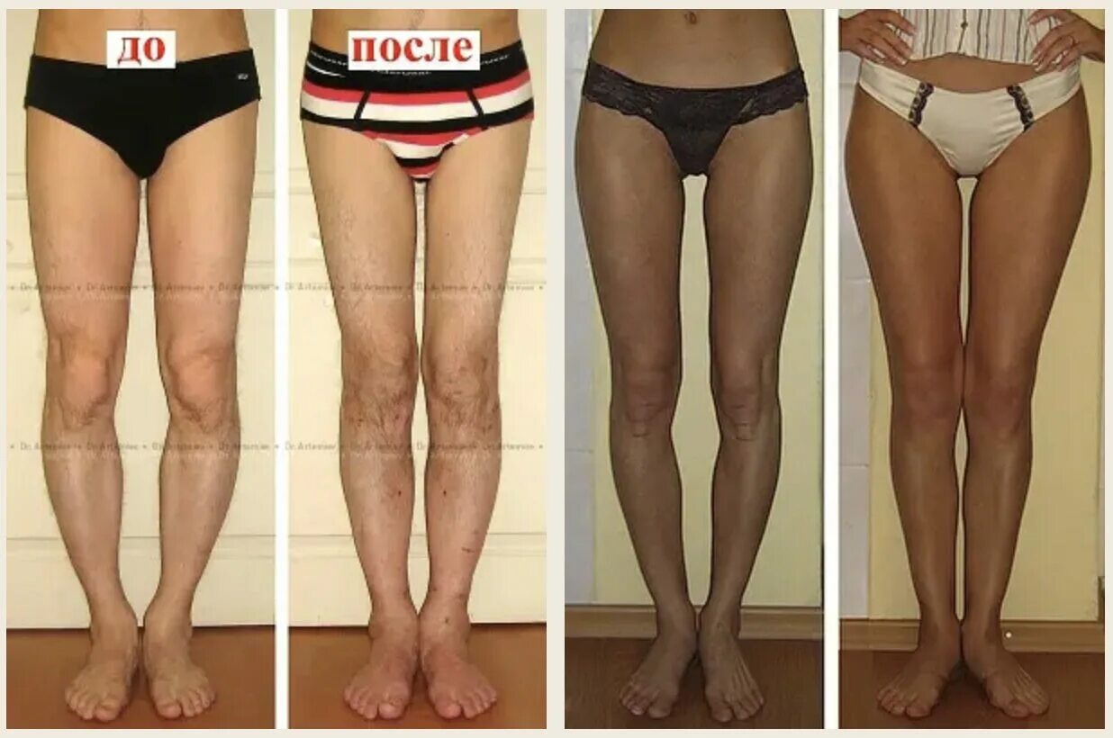 Дистанционное обучение: Школа здоровой осанки