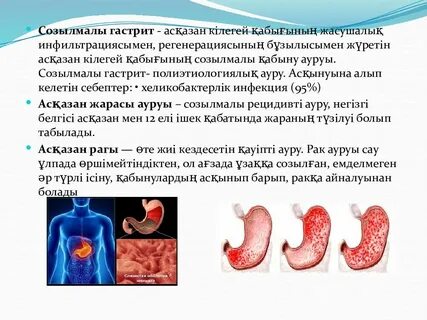 Хронический гастрит реферат
