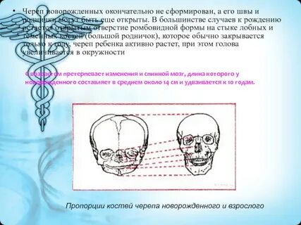 Черепной новорожденных
