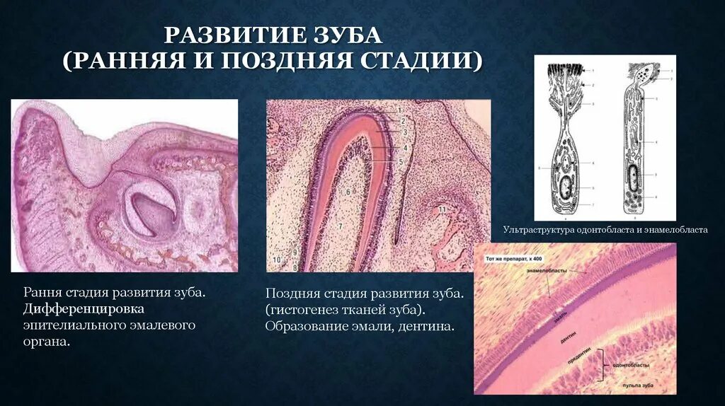 Стадии развития зуба. Поздняя стадия развития зуба образование дентина и эмали. Развитие зуба гистогенез гистология препарат. Стадия гистогенеза зуба гистология. Этапы развития зуба гистология.