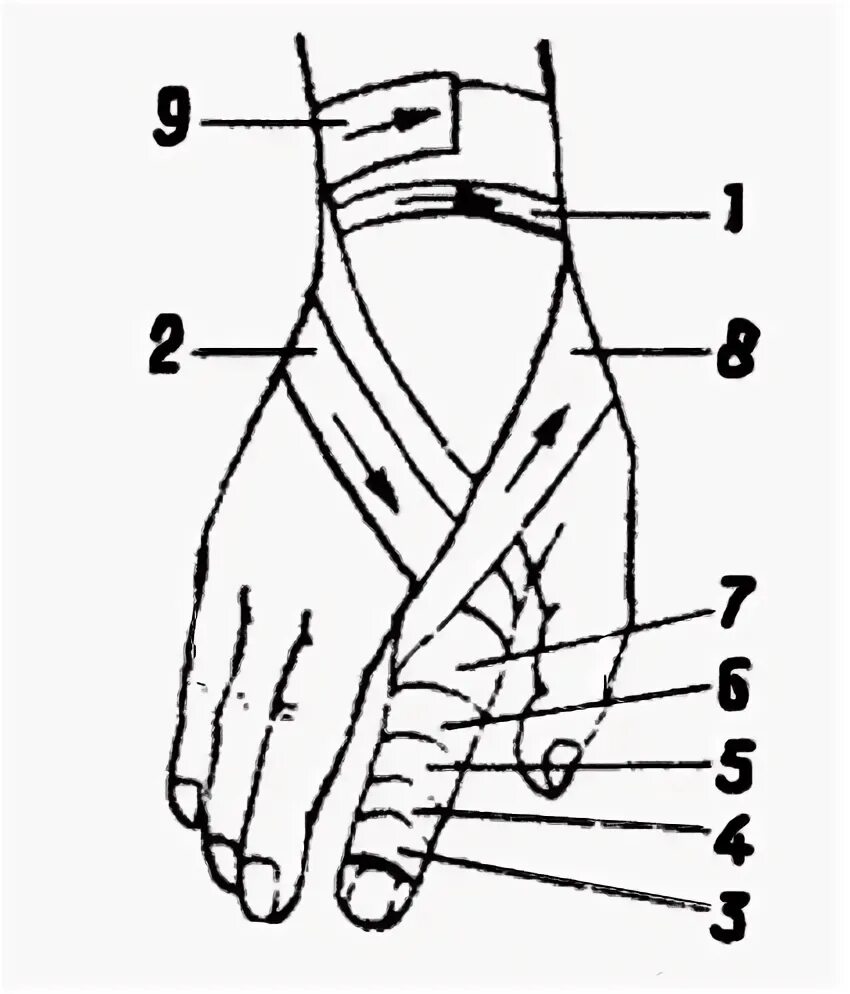 Повязка на кисть алгоритм. Схема бинтования пальца на руке. Восьмиобразная повязка на кисть техника. Десмургия лучезапястный сустав. Крестообразная (восьмиобразная) повязка на кисть.