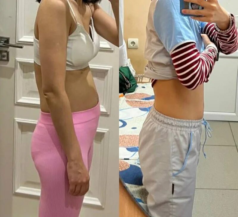 зрительное восприятие. визуал сноу. длинные и короткие ноги. звезды на ночном небе. фото живота при увеличенной печени.