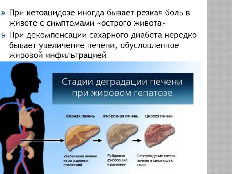 Декомпенсация цирроза