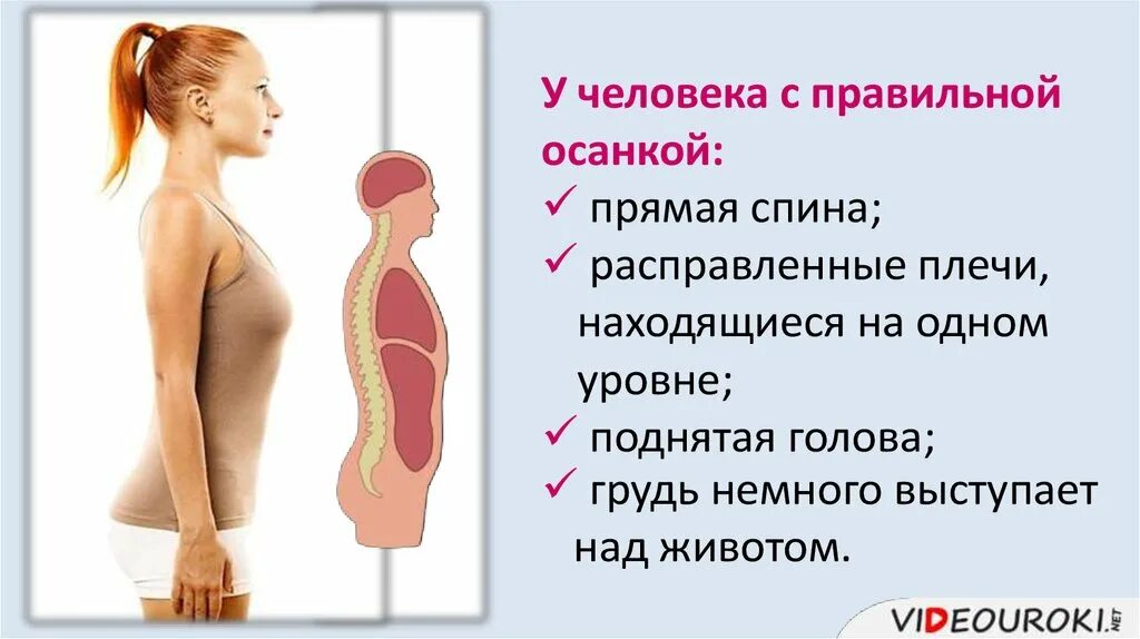 Нарушение осанки презентация 8 класс. Нарушение осанки и плоскостопие. осанка нарушение осанки плоскостопие. нарушение осанки и плоскостопие презентация. причины нарушения осанки и плоскостопия.