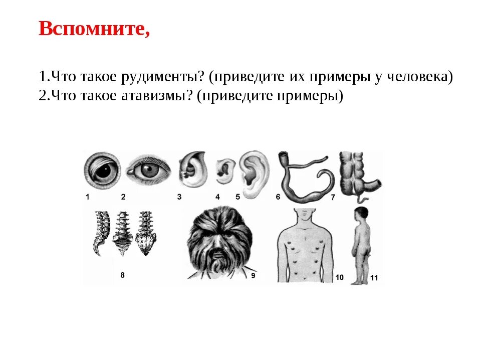 Рудименту атавизмам приведите. Рудименты и атавизмы у животных. Примеры рудиментов и атавизмов у человека. Рудименты и атавизмы человека таблица. Атавизмы и рудименты схема.