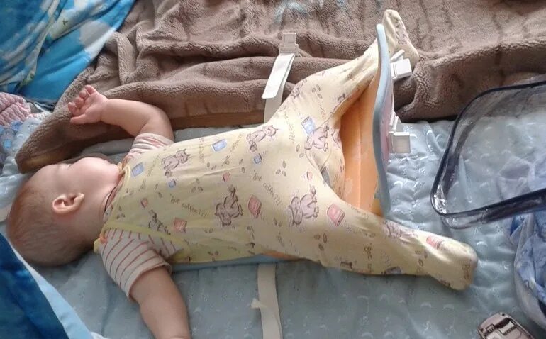 Запрокидывание головы у новорожденных. Запрокидывание головы назад у ребенка. Ребенок запрокидывает руку назад. Ребенок грудничок выгибает спину. Грудничок выгибает спину.