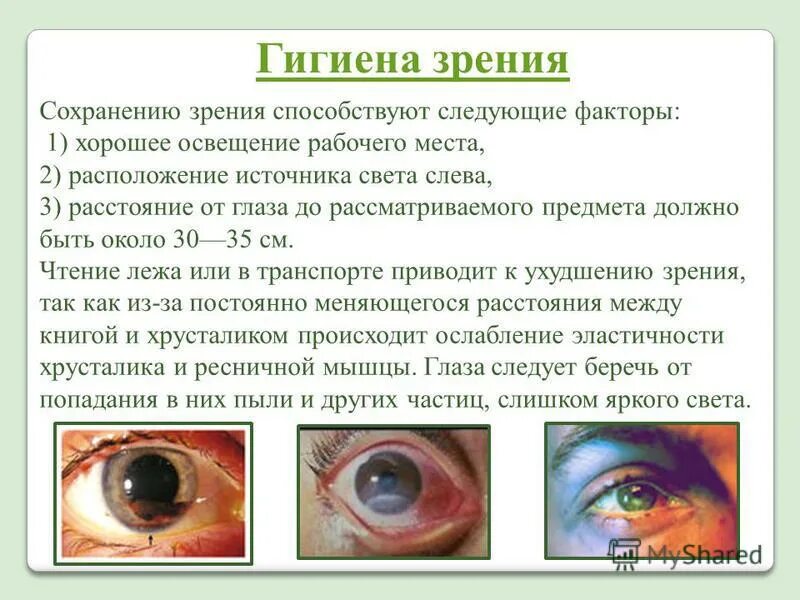 Органы чувств глаза 9 класс. Зрительный анализатор. Гигиена зрения. Болезни глаз.. Памятка гигиена органов зрения. Гигиена анализаторов зрения. Гигиена органов зрения кратко.