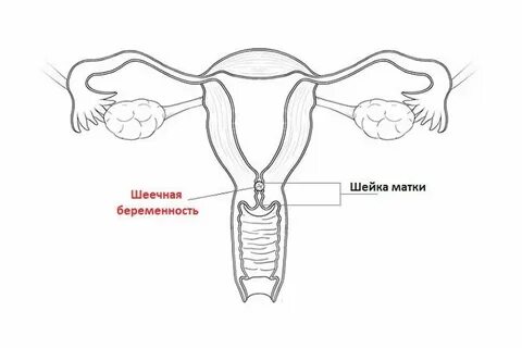 Одной трубой рожать можно