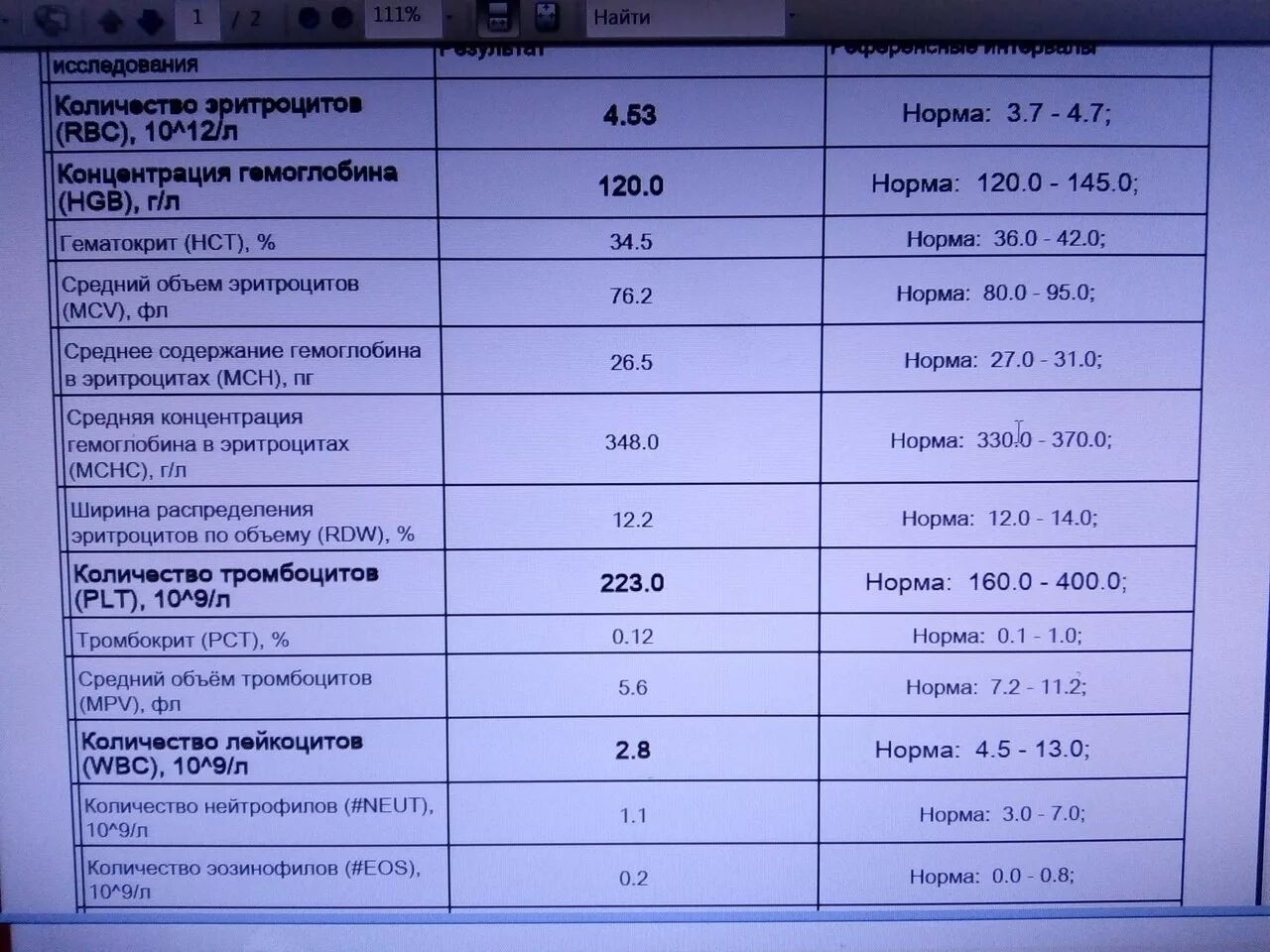 Нст в анализе крови. Расшифровка анализа EOS%. От/об норма. Аллергопробы норма. PLT 220 норма.