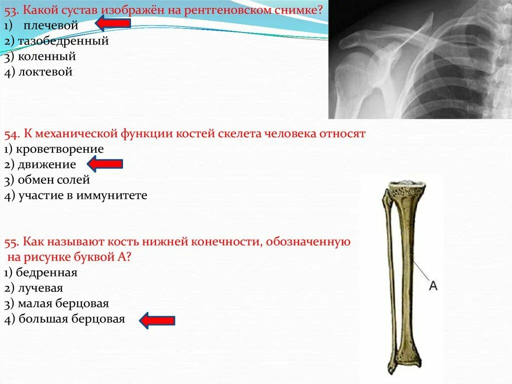 Какой сустав изображен