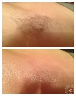 Писка бейнелері мен фотосуреттері