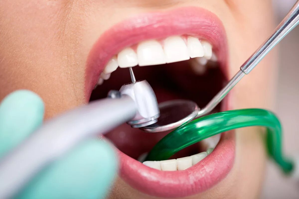 Скажи зуб. Терапия стоматология. Стоматологическая профилактика.