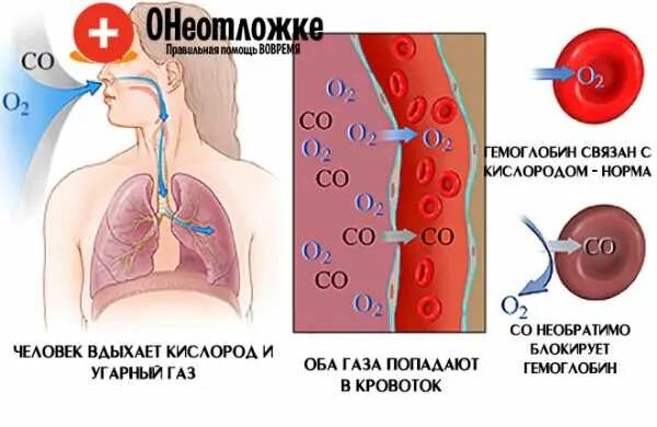 После попадания в организм. Патогенез отравления угарным газом. Токсическое действие угарного газа. Механизм действия угарного газа на организм. Отравление окисью углерода патогенез.