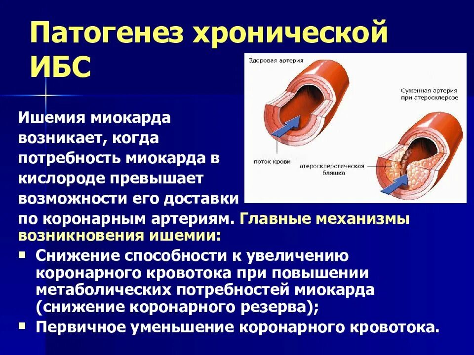 Ишемическая болезнь сердца симптомы. Причины острой ишемии миокарда. Ишемическое поражение миокарда. Механизмы развития ишемии патофизиология. Изменения в коронарных артериях при ишемической болезни сердца.