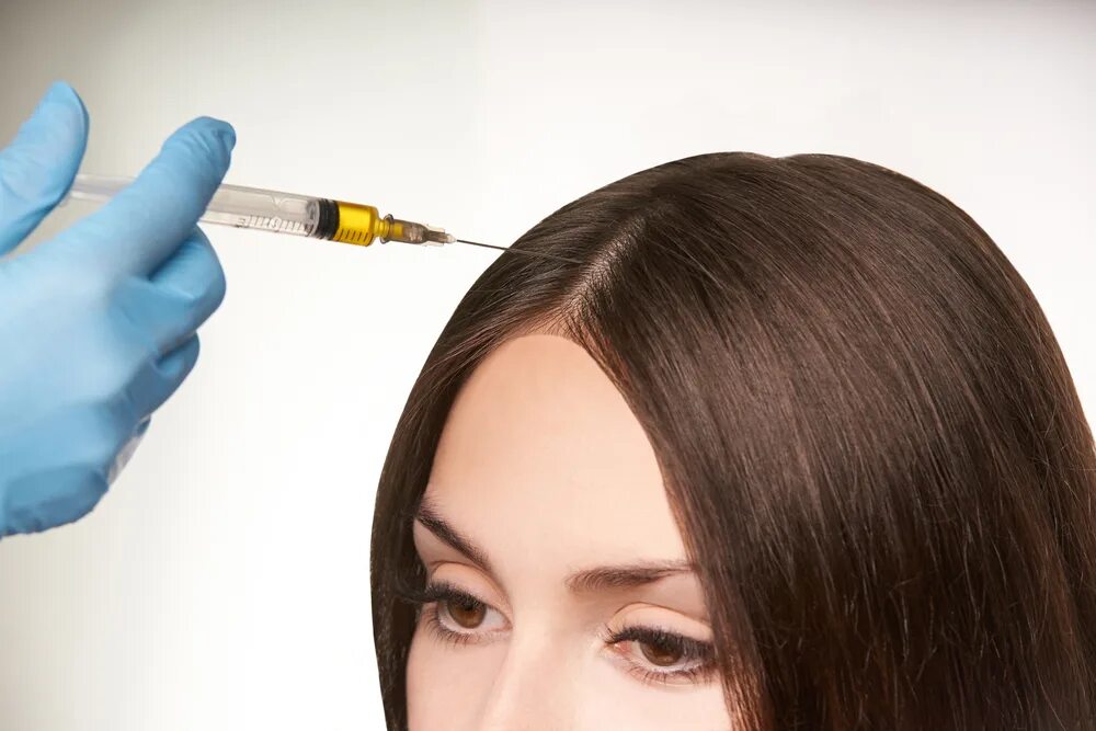 Инъекции головы. PRP-терапия (плазмотерапия) для волос. PRP плазмотерапия. Мезотерапия для волос.