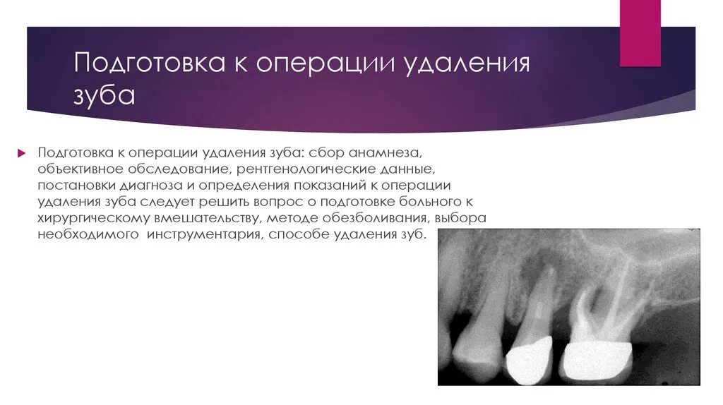 Операция удаление зубов. Показания к операции удаления зуба. Подготовка пациента к операции удаления зуба. Осложнения после ампутации
