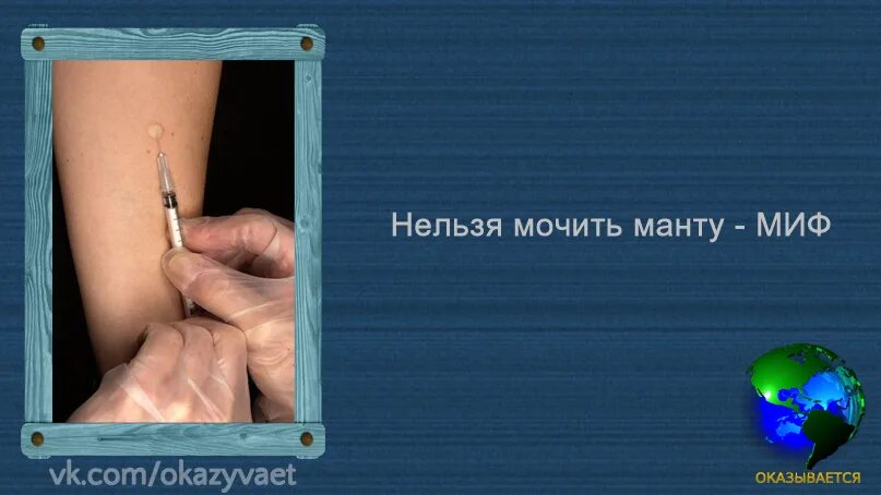 Сколько времени нельзя мочить. Почему нельзя мочить манту ребенку.