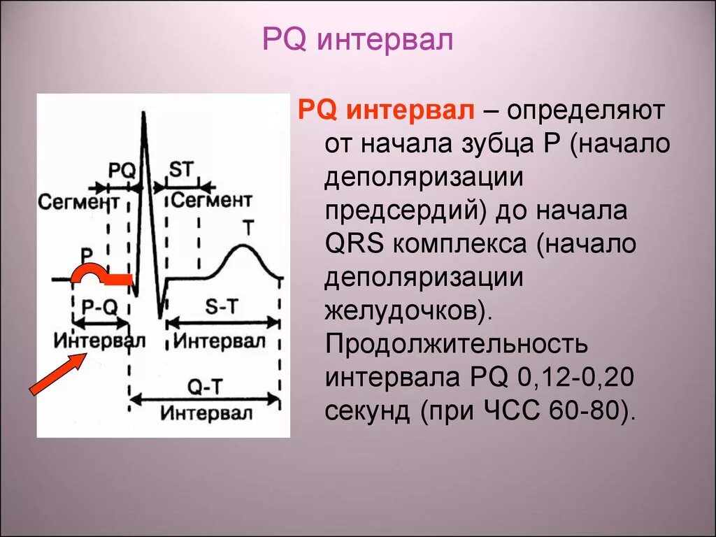 Удлинение интервала PQ на ЭКГ. Интервал PQ. PQ на ЭКГ. Интервал PQ на ЭКГ. Аналитический интервал