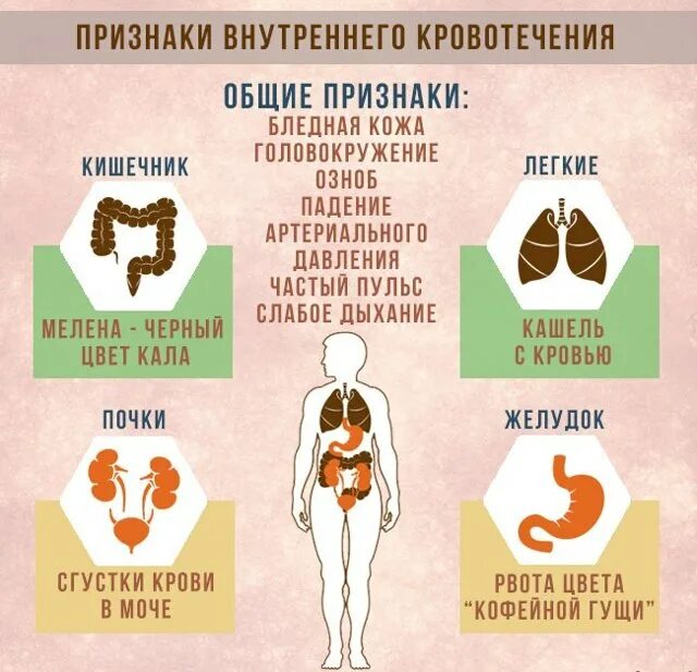 Симптомы при внутреннем кровотечении