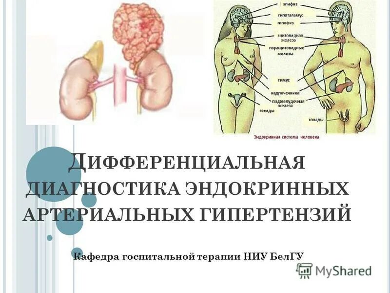 Диагностика в эндокринологии. Эндокринные артериальные гипертензии. Эндокринные артериальные гипертензии диагностика. Вторичные эндокринные артериальные гипертензии. Эндокринные артериальные гипертензии классификация.