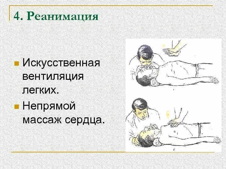 Искуственная вентиляция легких алгоритм кратко. Искусственная вентиляция лёгких и непрямой массаж сердца. Непрямой массаж сердца при поражении электрическим током. ИВЛ И непрямой массаж сердца.