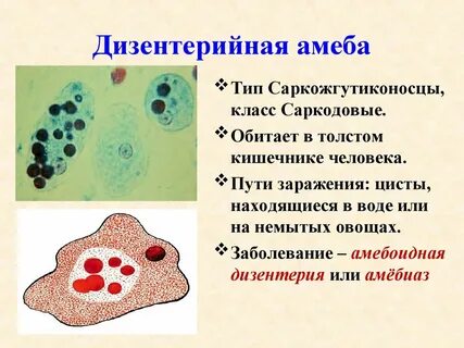Дизентерию вызывает простейшее