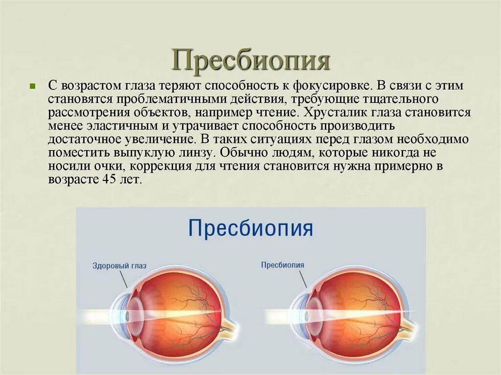 Миопия гиперметропия астигматизм пресбиопия. Факогенная миопия. Причины развития близорукости и дальнозоркости. Миопический астигматизм пресбиопия очки. Близорукость причины возникновения