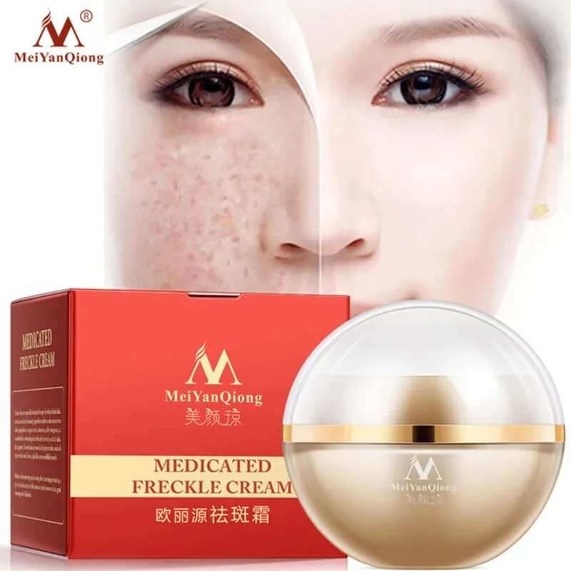 Крем отбеливающий MEIYANQIONG. Крем для лица Freckle Cream. Крем для веснушка для лица. Отбеливающий крем для веснушек. Крем против веснушек