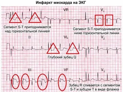 Балапан жалап, сәуегейлейді