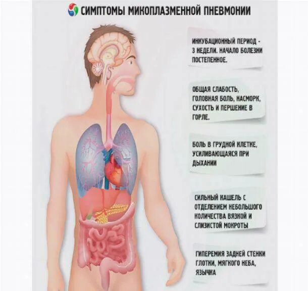 Боль в легком при пневмонии. Болит ли при пневмонии.