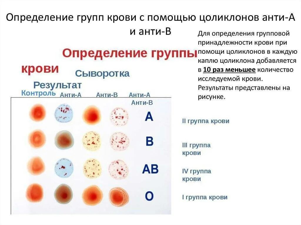 Определите резус фактора группы крови человека. Наборы реагентов для определения групп крови и резус-фактора. Определение группы крови по цоликлонам таблица. Цоликлоны для определения группы крови таблица. Определение d резус определение