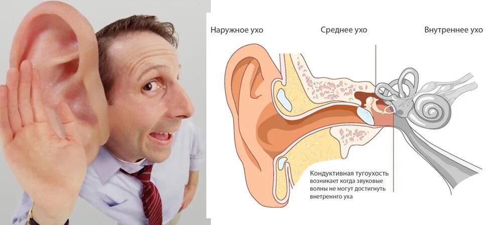 Профессиональная нейросенсорная тугоухость патогенез. Кондуктивные нарушения слуха. Проявления нарушения слуха. То что слышит человек физика