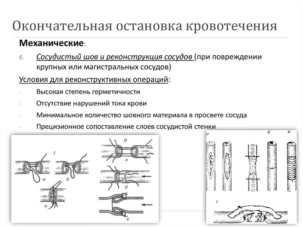 Механические методы окончательной остановки кровотечения. Механический метод окончательной остановки кровотечения. Укажите метод окончательной остановки венозного кровотечения?. Метод окончательной остановки артериального кровотечения:.