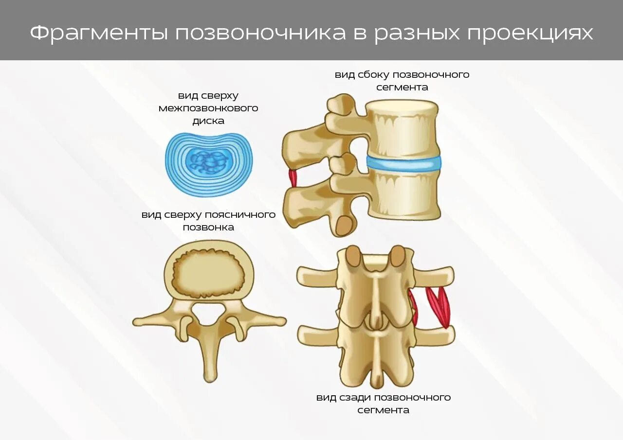 Синдромы остеохондроза поясничного отдела. Корешковые симптомы. Корешковый синдром. Корешковый позвонок. Корешковый канал позвоночника.