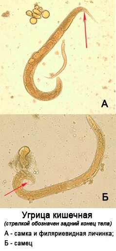 Личинки угрицы кишечной. Угрица кишечная личинки. Угрица кишечная строение.