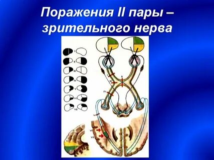 Зрительная пара черепных нервов