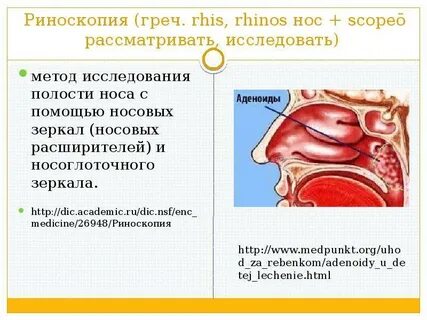 Степени аденоидита у детей