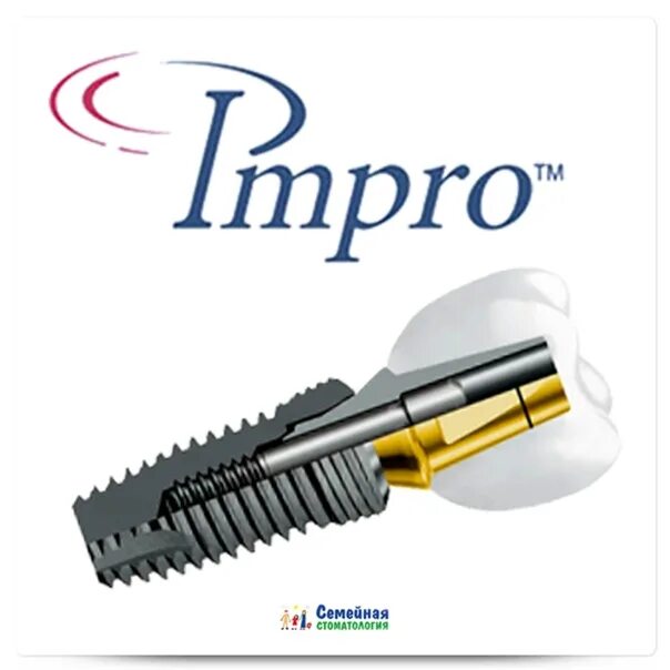 Импро импланты 3. Импро импланты. Немецкие импланты impro. Импро импланты. Импро импланты.