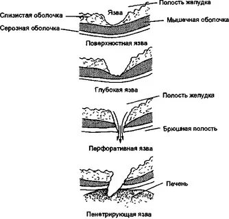 Поверхностная оболочка
